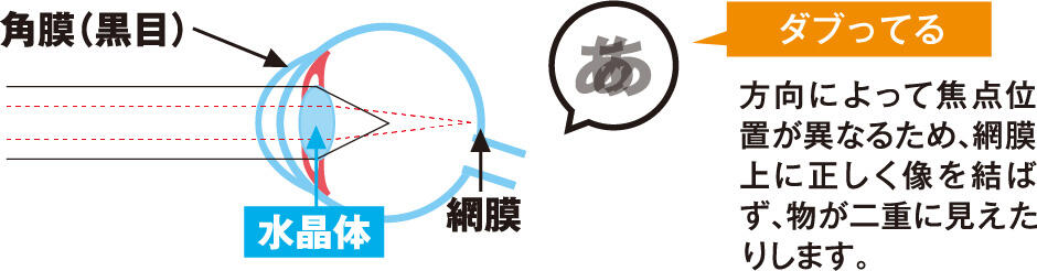 【ダブってる】方向によって焦点位置が異なるため、網膜上に正しく像を結ばず、物が二重に見えたりします。