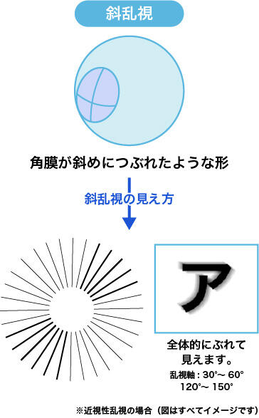 斜乱視:角膜が斜めにつぶれたような形 斜乱視の見え方:全体的にぶれて見えます。 乱視軸:30°~60°、120°~150° ※近視性乱視の場合(図はすべてイメージです)