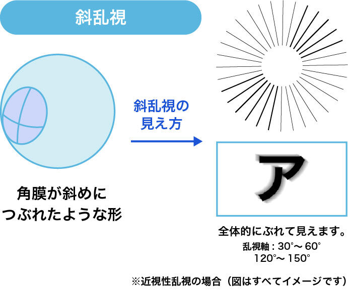 斜乱視:角膜が斜めにつぶれたような形 斜乱視の見え方:全体的にぶれて見えます。 乱視軸:30°~60°、120°~150° ※近視性乱視の場合(図はすべてイメージです)